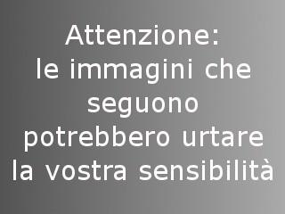 Attilio Manca